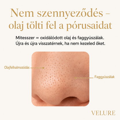 Velure DermLift™ - Mikrorezgéses Mitesszer Eltávolító