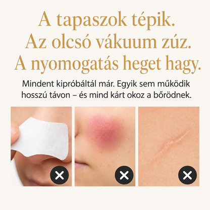 Velure DermLift™ - Mikrorezgéses Mitesszer Eltávolító
