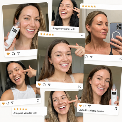 Velure DermLift™ - Mikrorezgéses Mitesszer Eltávolító